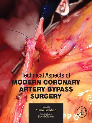 cover image of Technical Aspects of Modern Coronary Artery Bypass Surgery